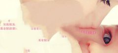 促排卵期间注意什么